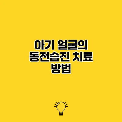아기 얼굴의 동전습진 치료 방법